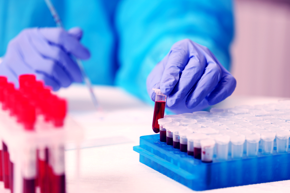 Exames Laboratoriais