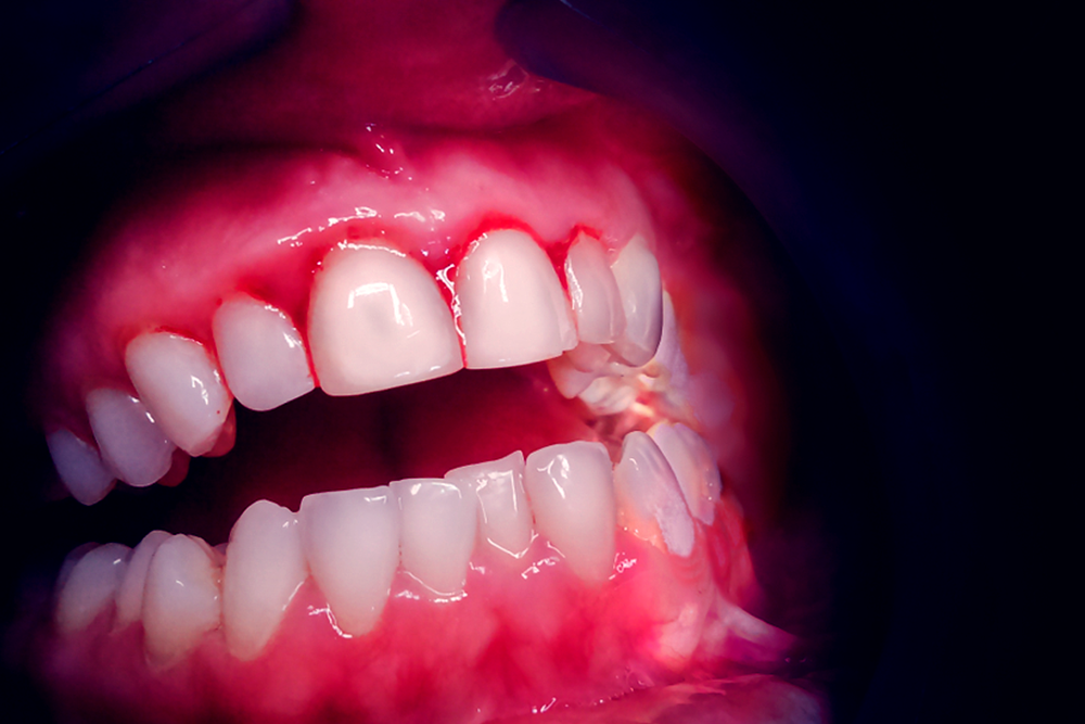 Periodontia